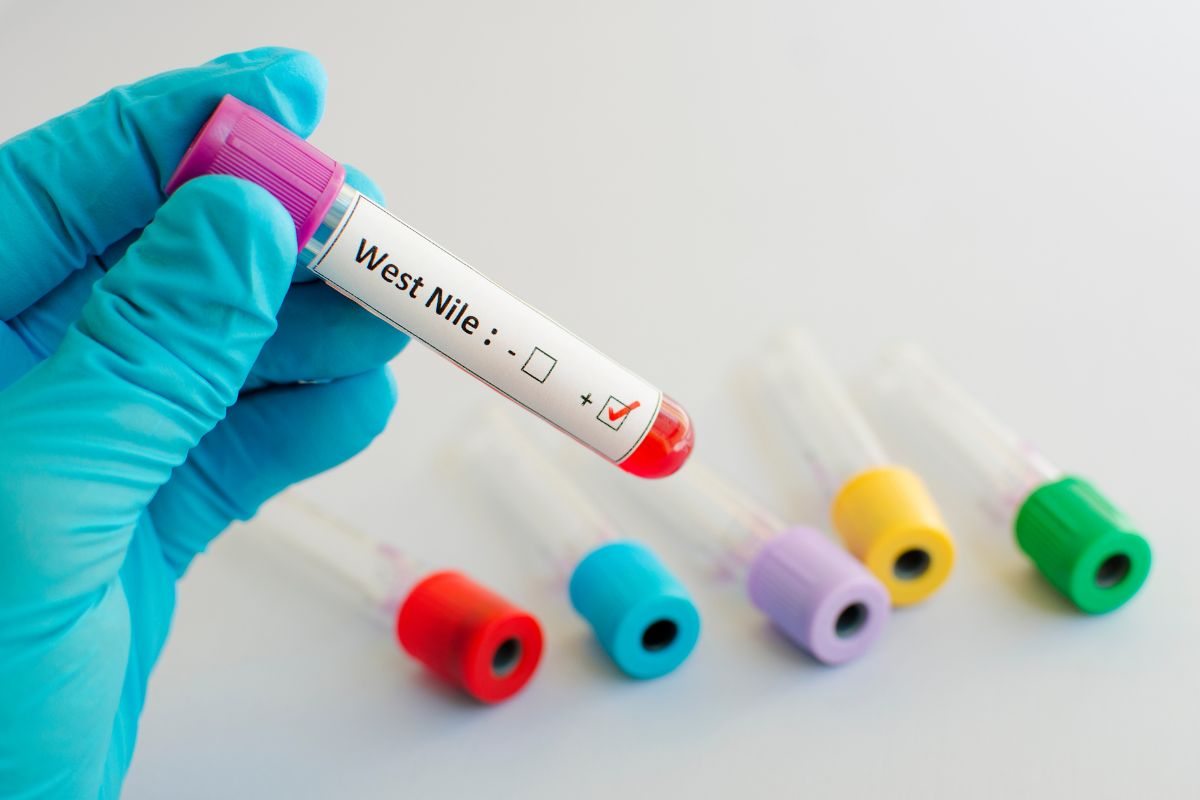 Risultati positivi West Nile campione sangue
